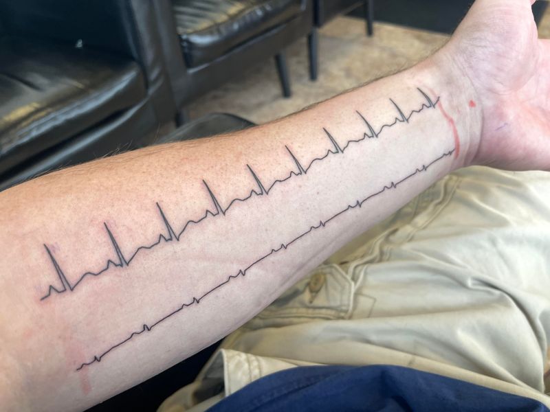 Heartbeat That Lives On